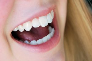 smile-1434166